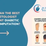How Can the Best Diabetologist Prevent Diabetic Foot Amputation?