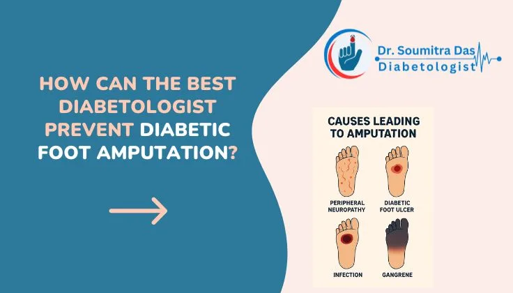 How Can the Best Diabetologist Prevent Diabetic Foot Amputation?